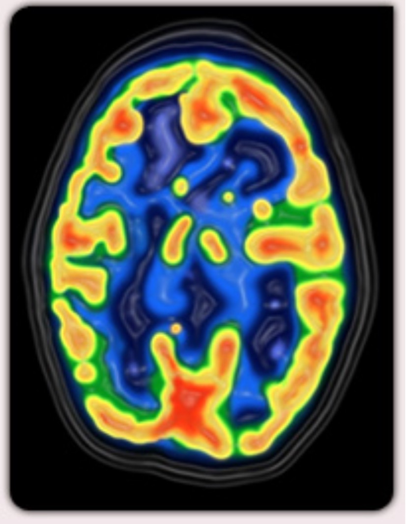 Aider les autres et soi même grâce aux neurosciences :&nbsp;l’hypnose&nbsp;